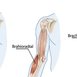 Brachialis Strain Pain Physiotherapy