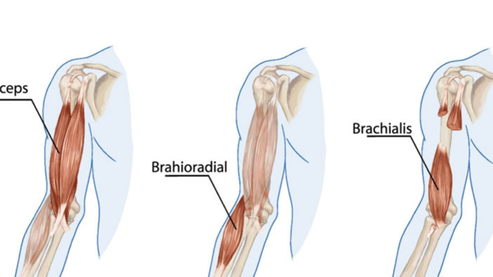 Brachialis Strain Pain Physiotherapy