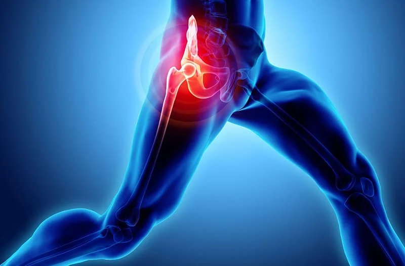 Sports Medicine Hip Flexor Strain