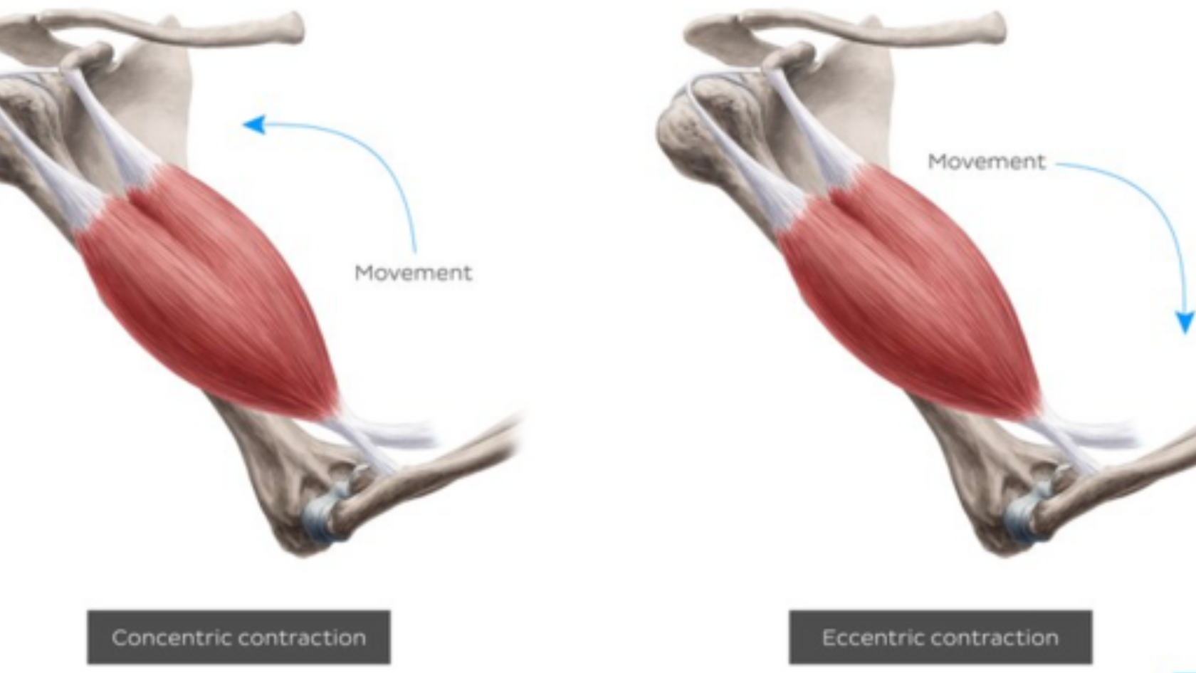 What Causes Muscle Soreness After a Workout?